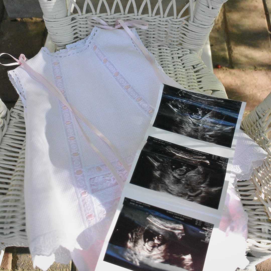 Photo shared by Brooke for their Babylist baby registry.