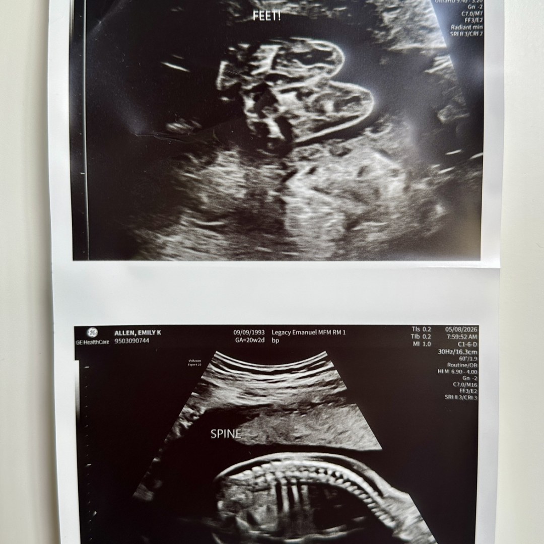 Photo shared by Emily for their Babylist baby registry.