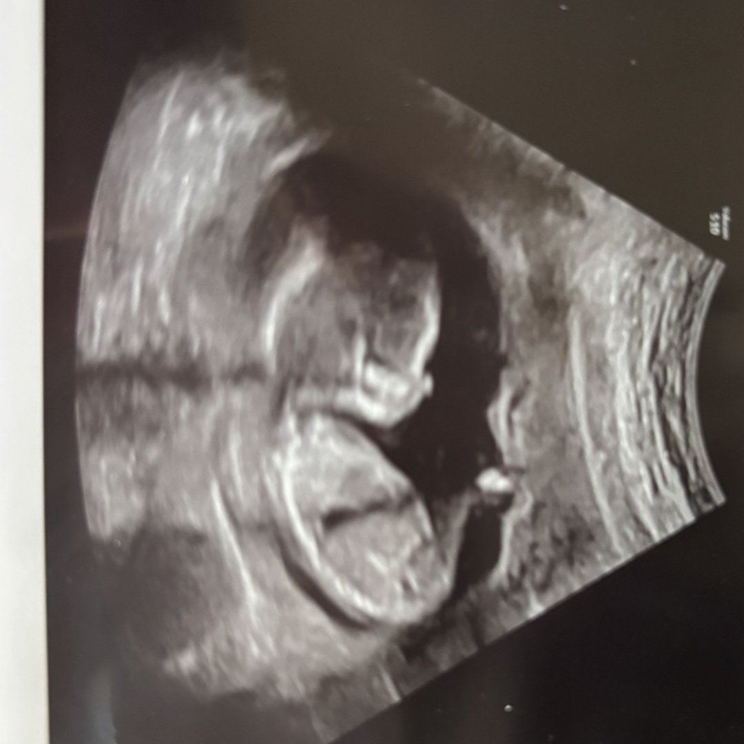 Photo shared by Adison for their Babylist baby registry.