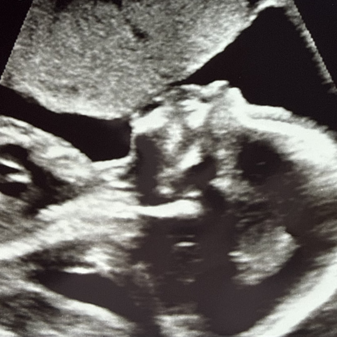 Photo shared by Claudia Michelle for their Babylist baby registry.