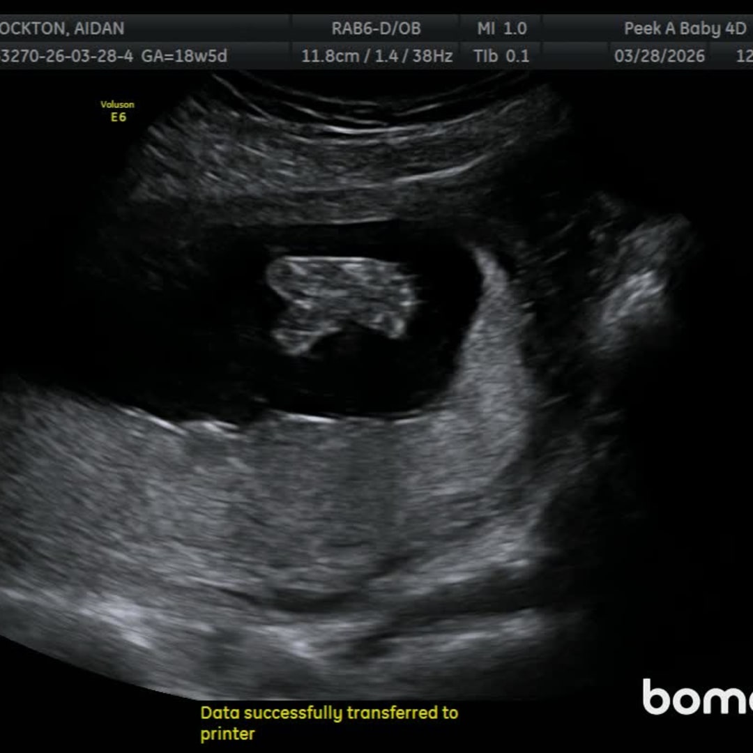 Photo shared by Aidan for their Babylist baby registry.