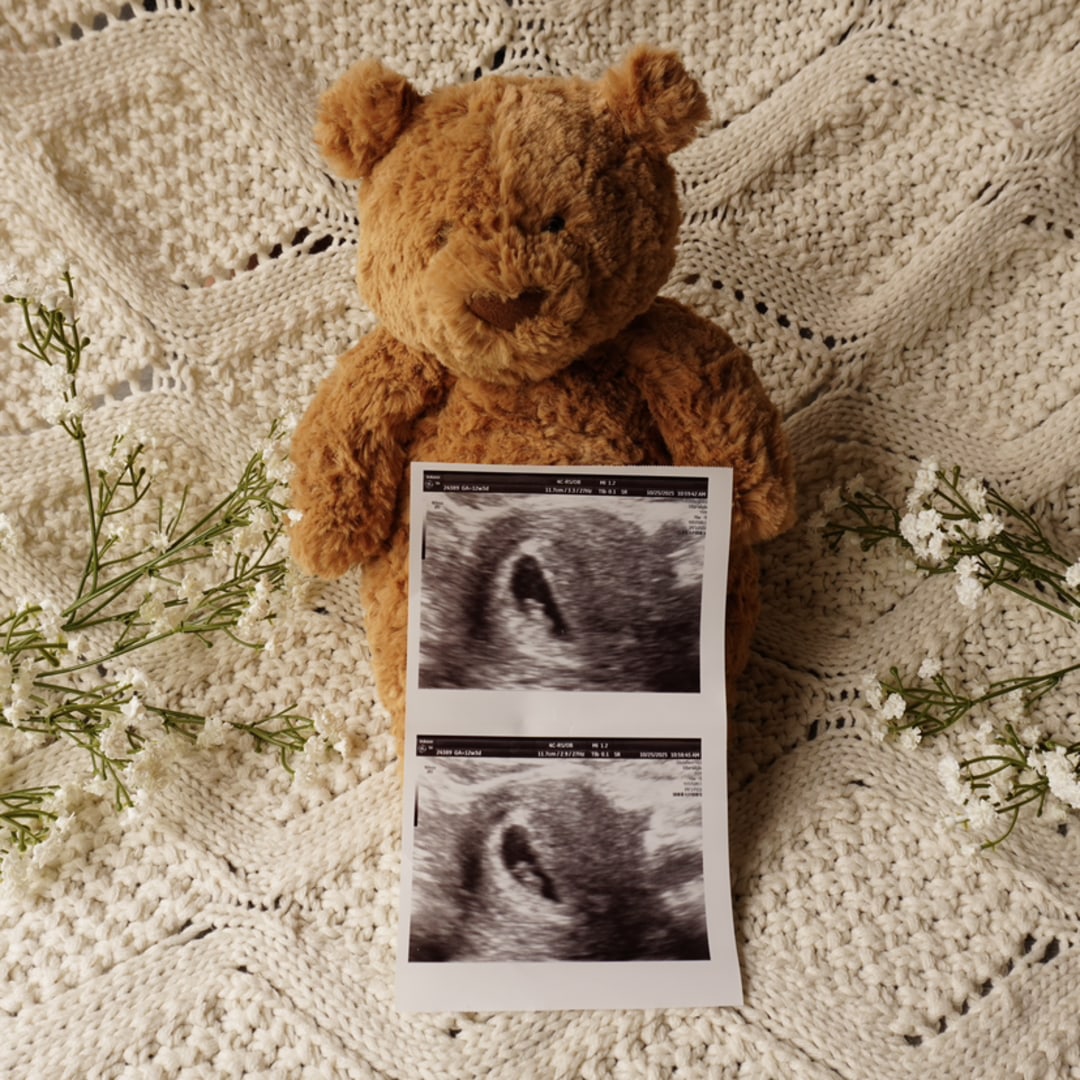 Photo shared by Laura for their Babylist baby registry.