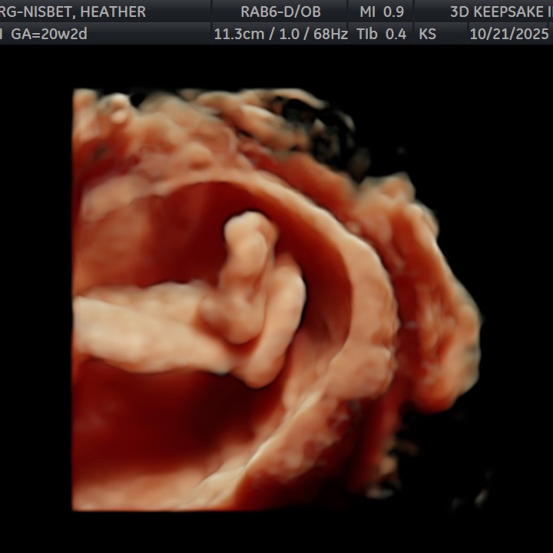 Photo shared by Heather for their Babylist baby registry.