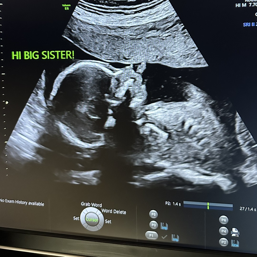 Photo shared by Kristin for their Babylist baby registry.