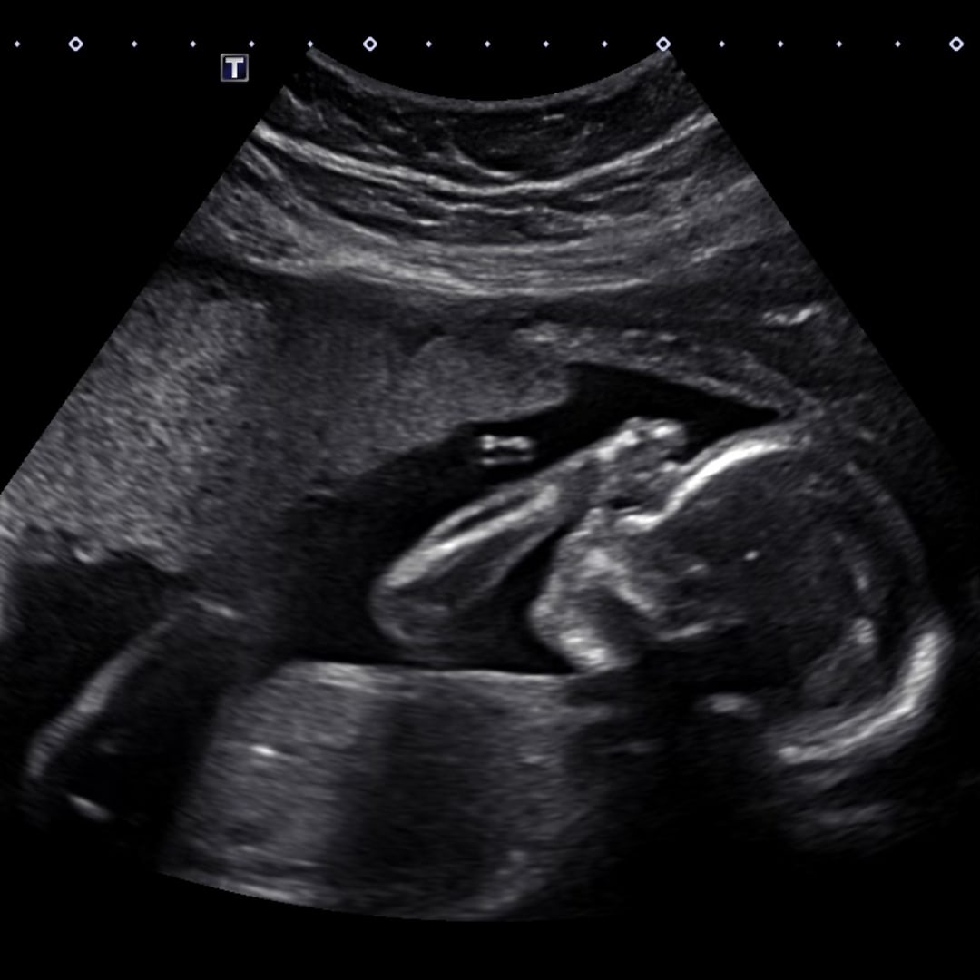 Photo shared by Rebecca for their Babylist baby registry.