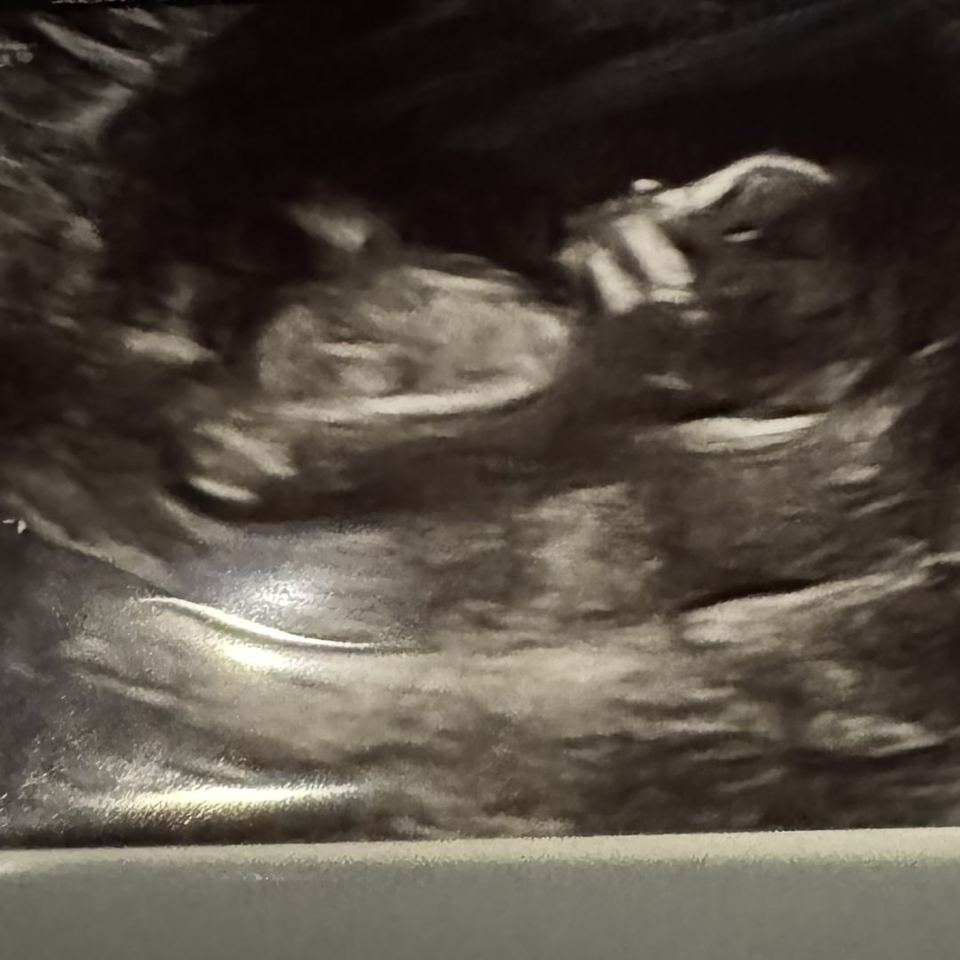 Photo shared by Hope for their Babylist baby registry.