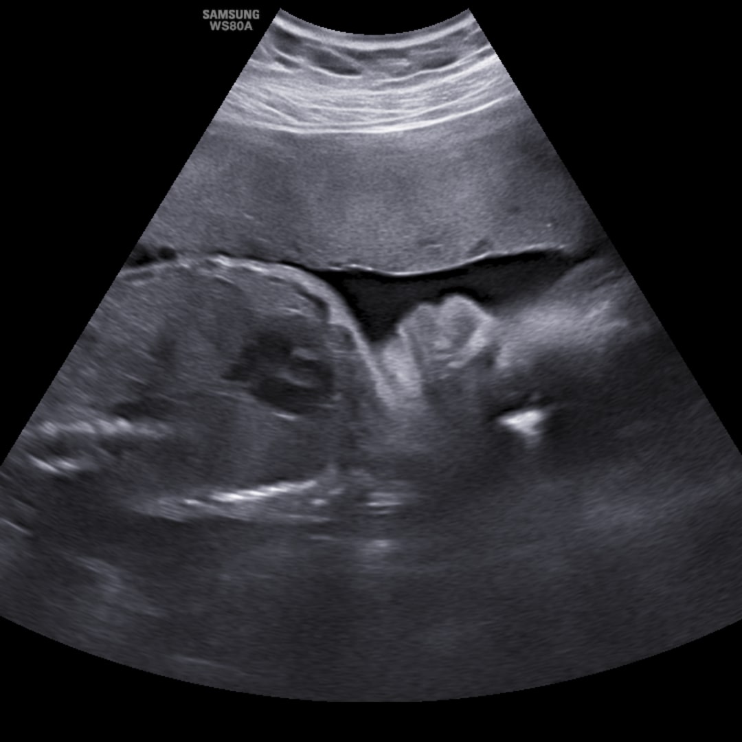 Photo shared by Grace for their Babylist baby registry.