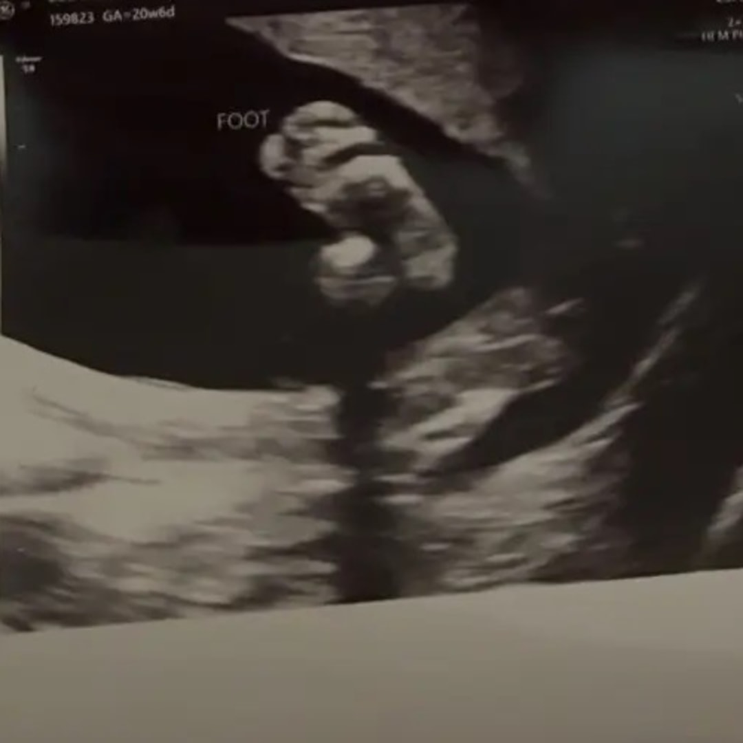 Photo shared by Audrey for their Babylist baby registry.