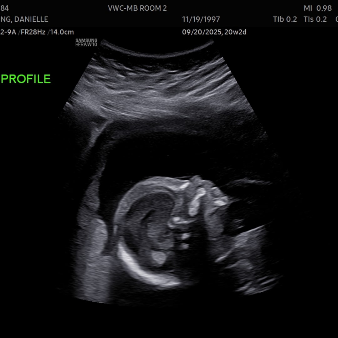 Photo shared by Danielle for their Babylist baby registry.