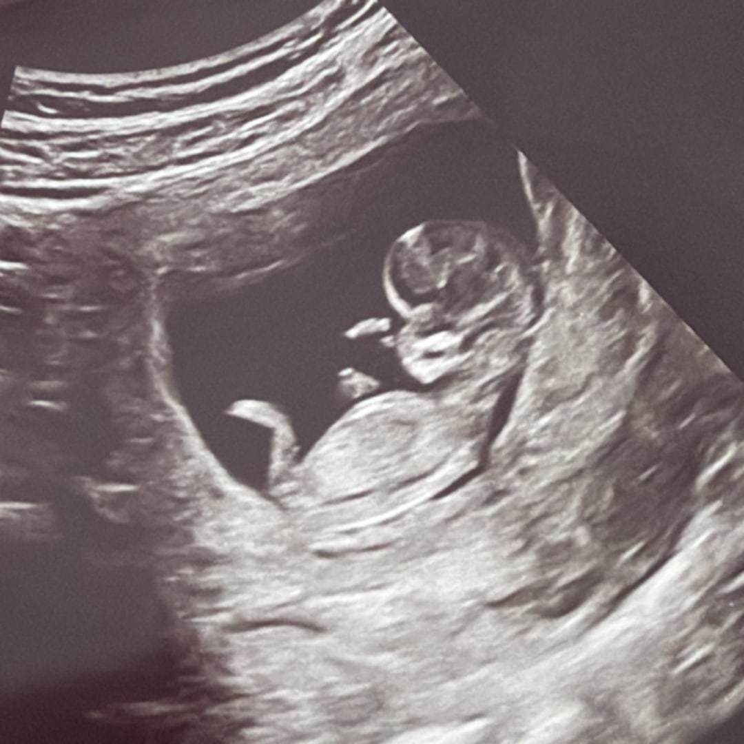 Photo shared by Maryane for their Babylist baby registry.