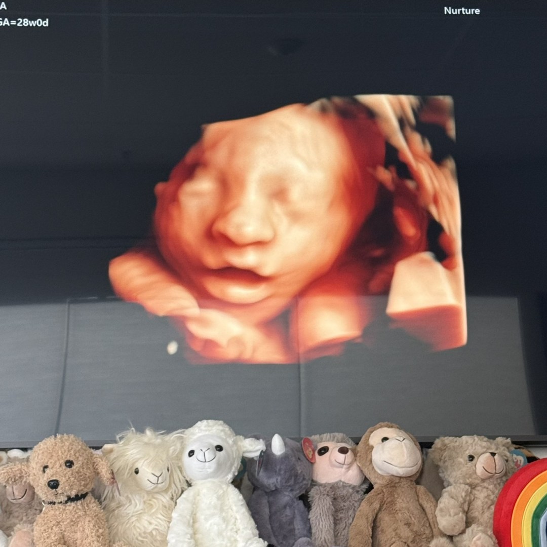 Photo shared by Julianna for their Babylist baby registry.