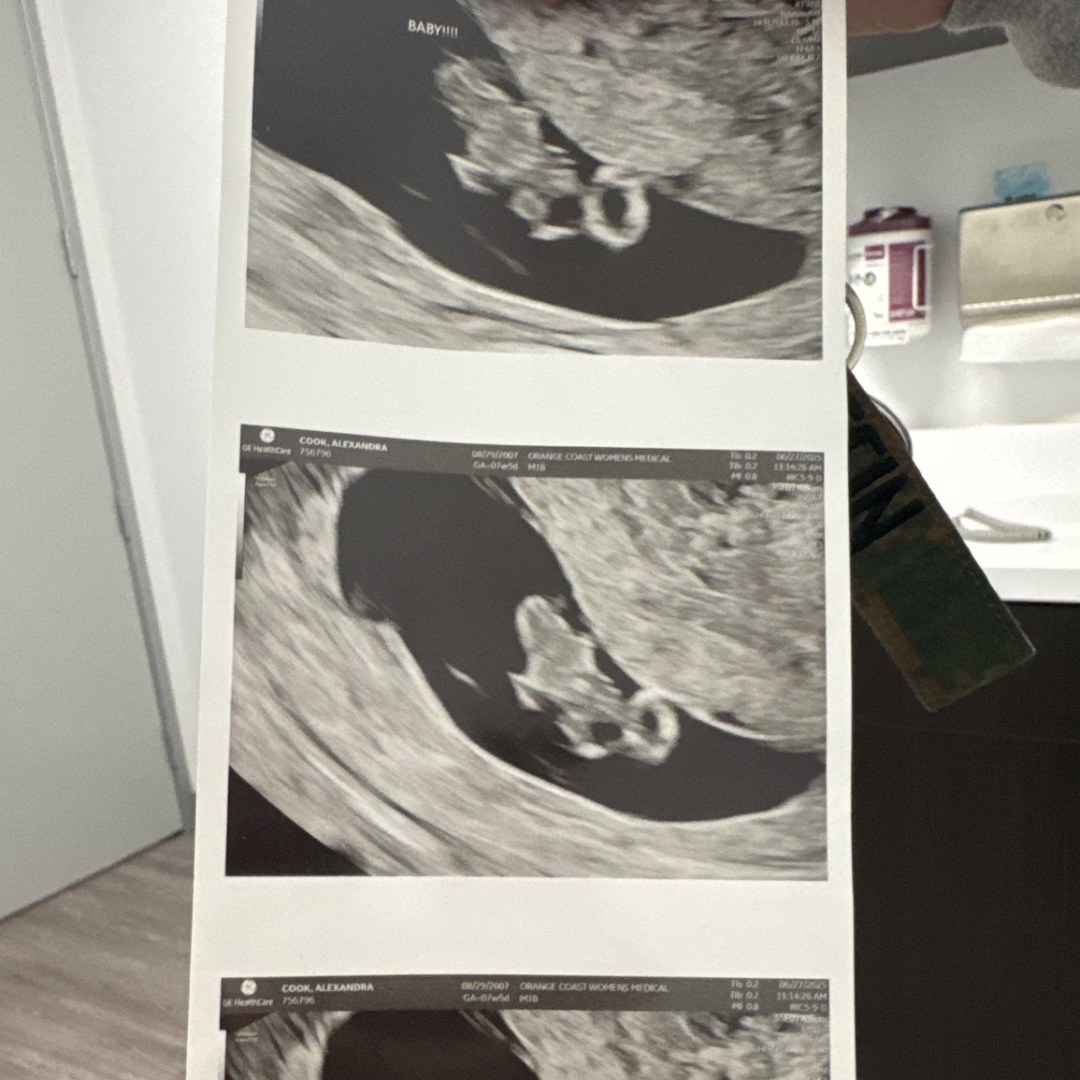Photo shared by Alexandra for their Babylist baby registry.