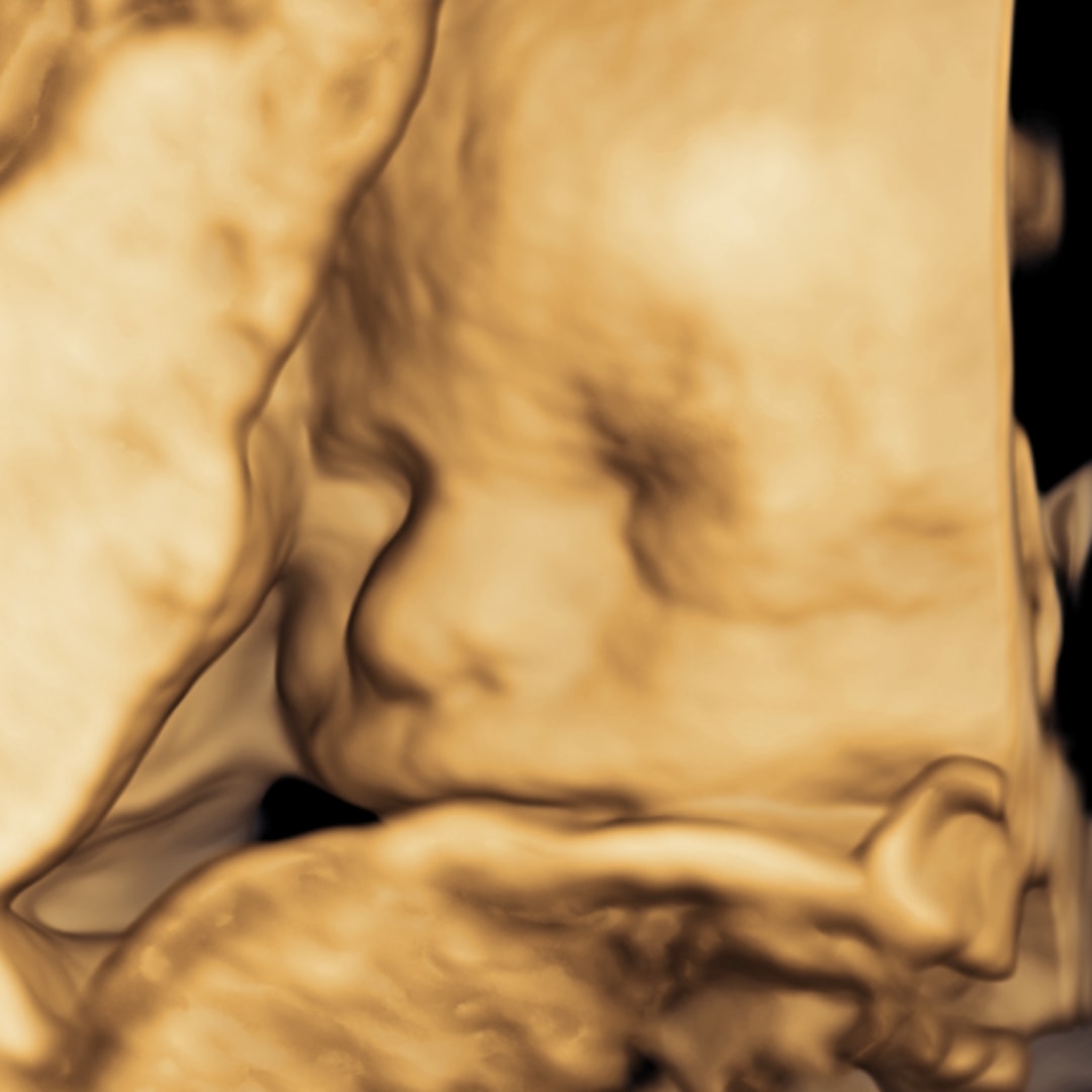 Photo shared by Summer for their Babylist baby registry.