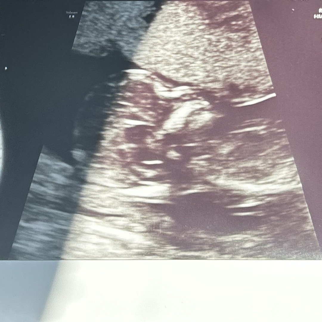 Photo shared by Marinelys for their Babylist baby registry.