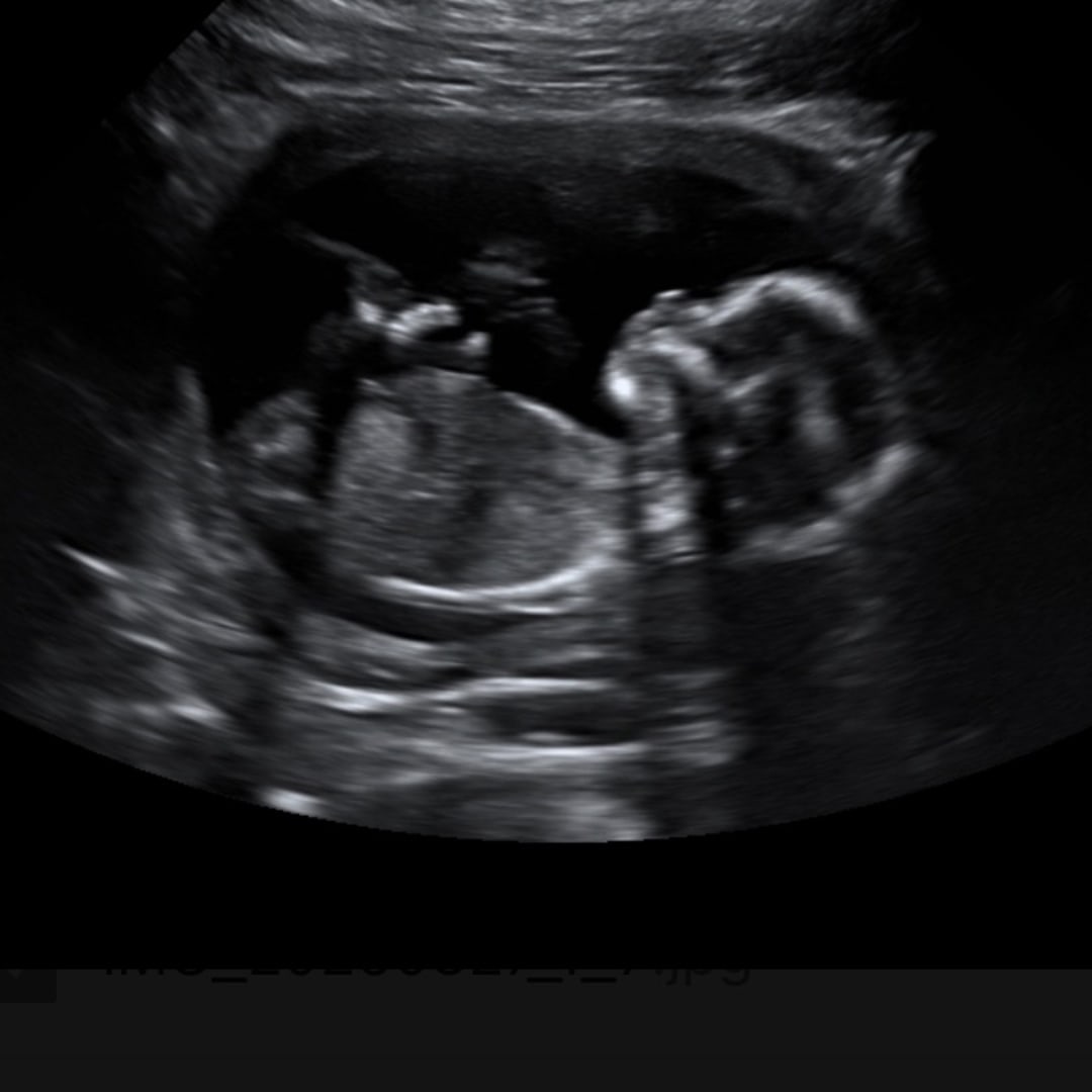 Photo shared by Janel for their Babylist baby registry.