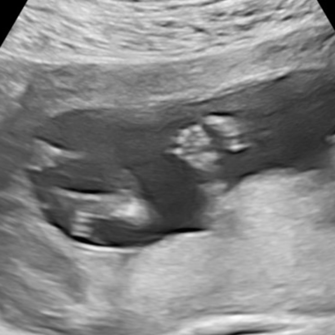 Photo shared by Marilyn and Patrick for their Babylist baby registry.