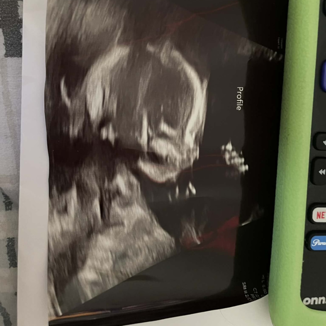 Photo shared by Deandra for their Babylist baby registry.