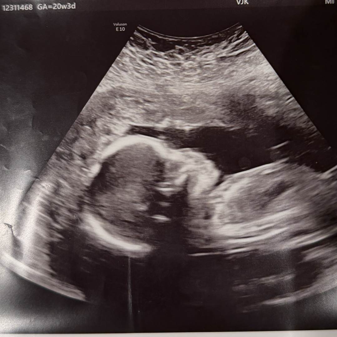 Photo shared by Madeleine for their Babylist baby registry.