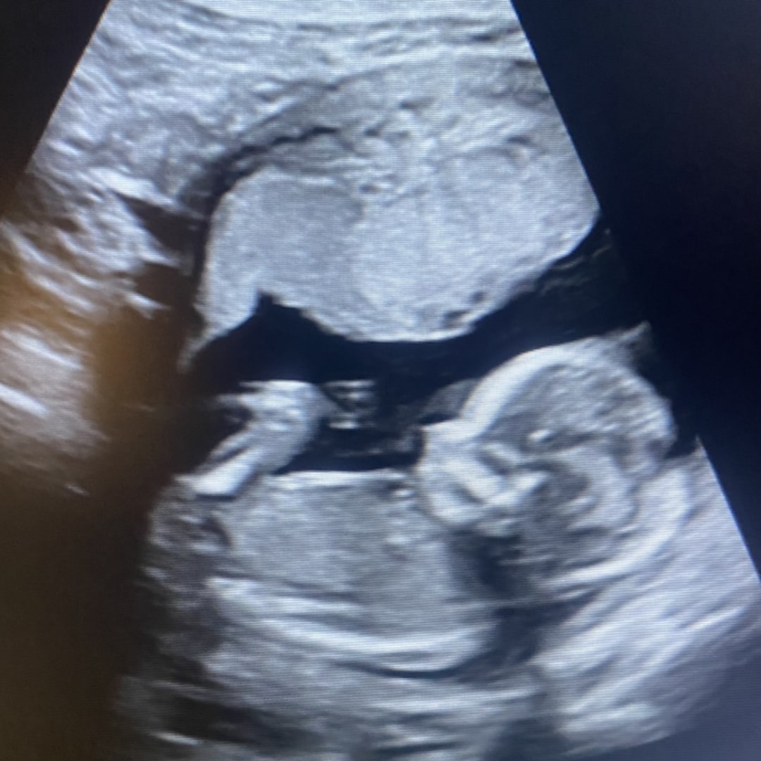 Photo shared by Shakiah for their Babylist baby registry.