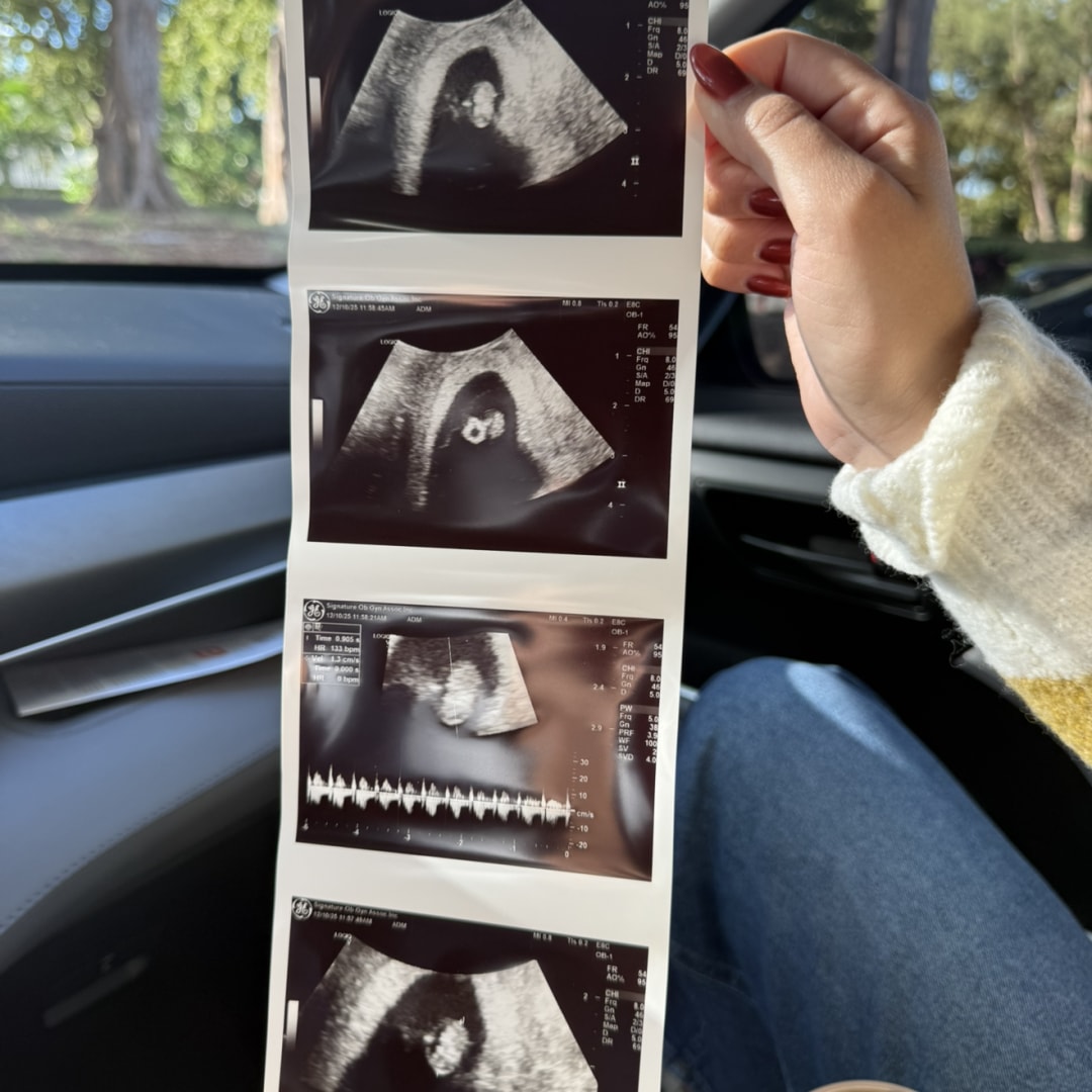 Photo shared by Alejandra for their Babylist baby registry.