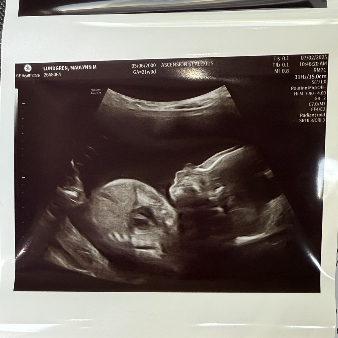 Photo shared by Madlynn for their Babylist baby registry.