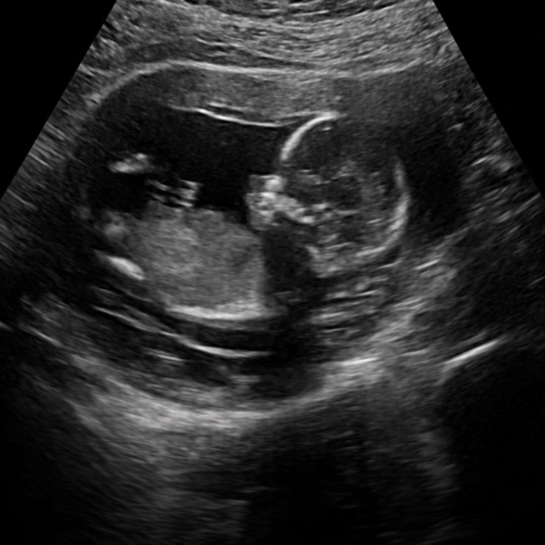 Photo shared by Samantha for their Babylist baby registry.