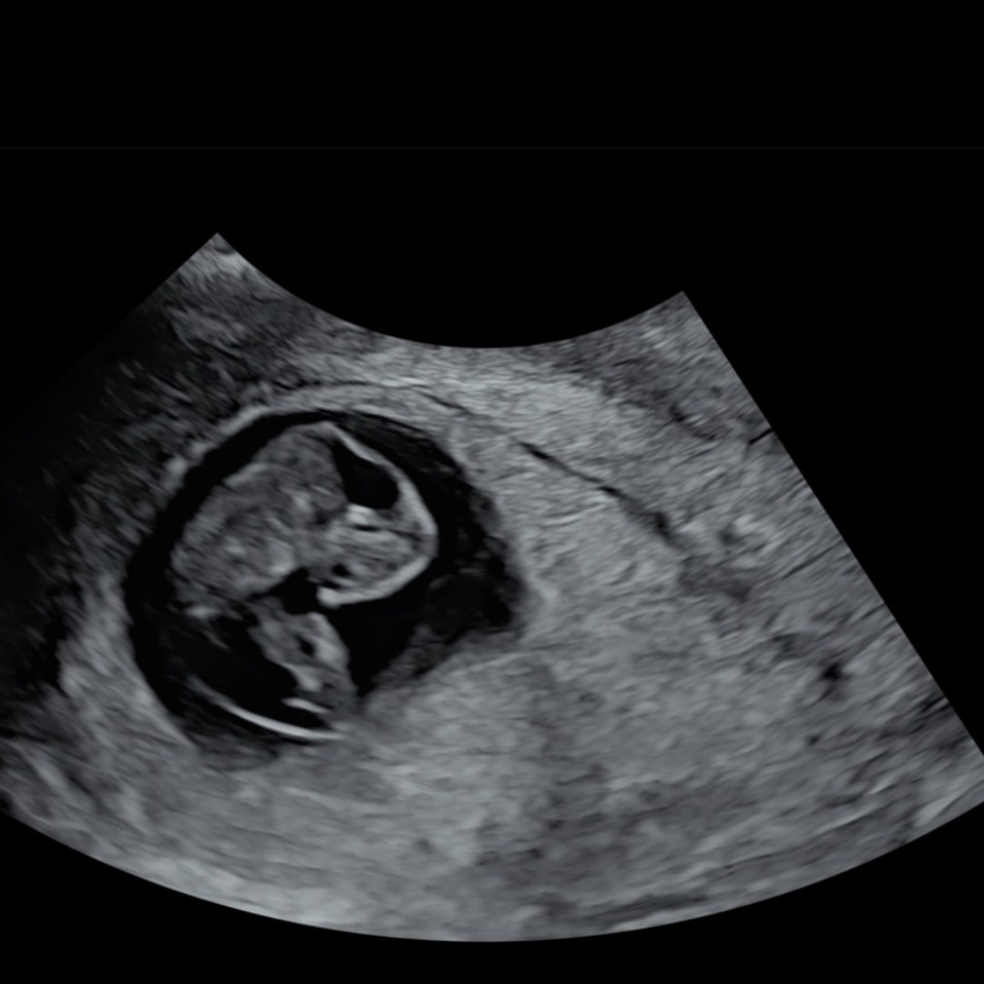 Photo shared by Gracie for their Babylist baby registry.