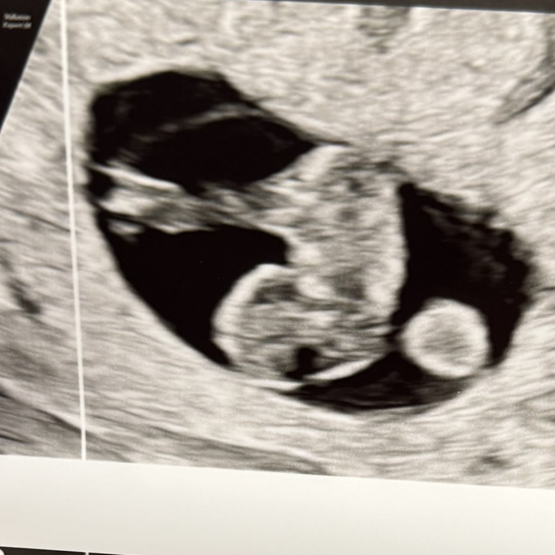 Photo shared by Meagan for their Babylist baby registry.