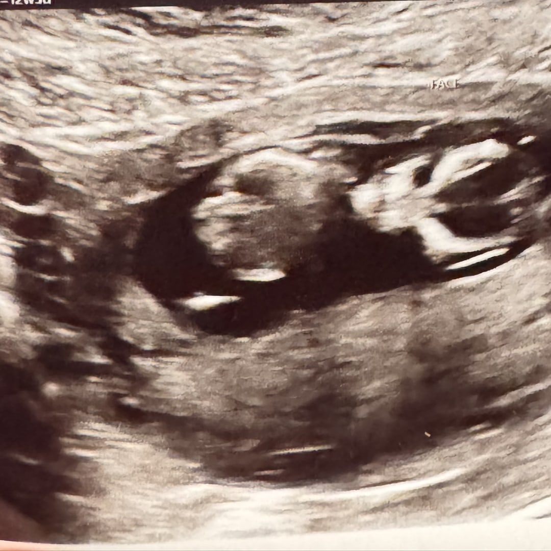 Photo shared by Jenn for their Babylist baby registry.