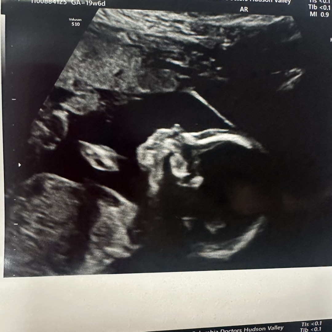 Photo shared by Rebecca for their Babylist baby registry.