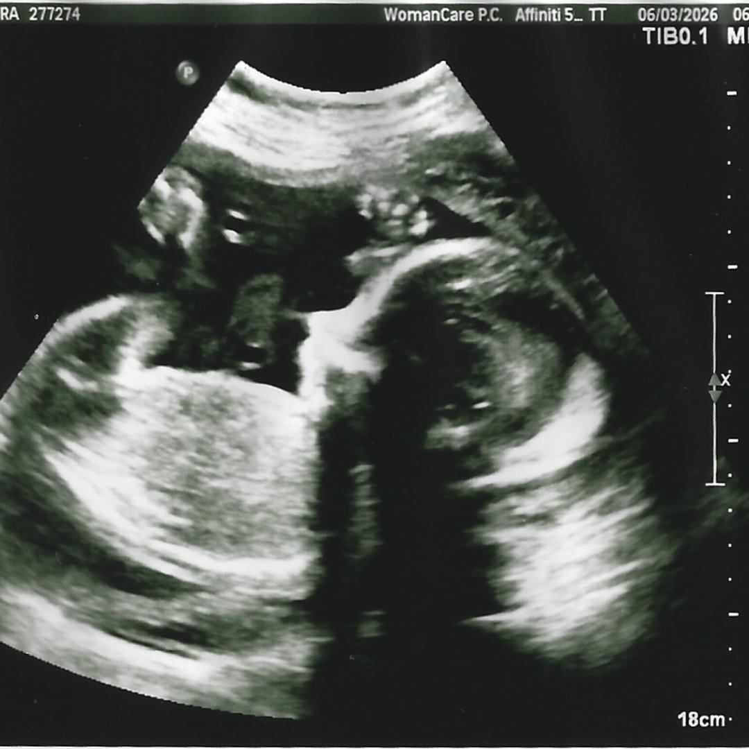 Photo shared by Aleksandra for their Babylist baby registry.