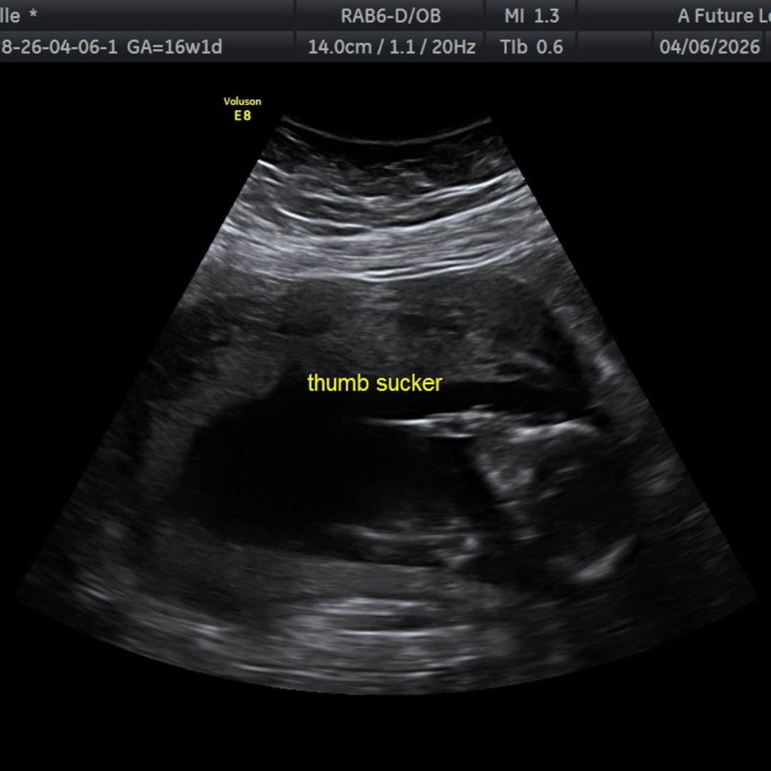 Photo shared by Jazzelle for their Babylist baby registry.