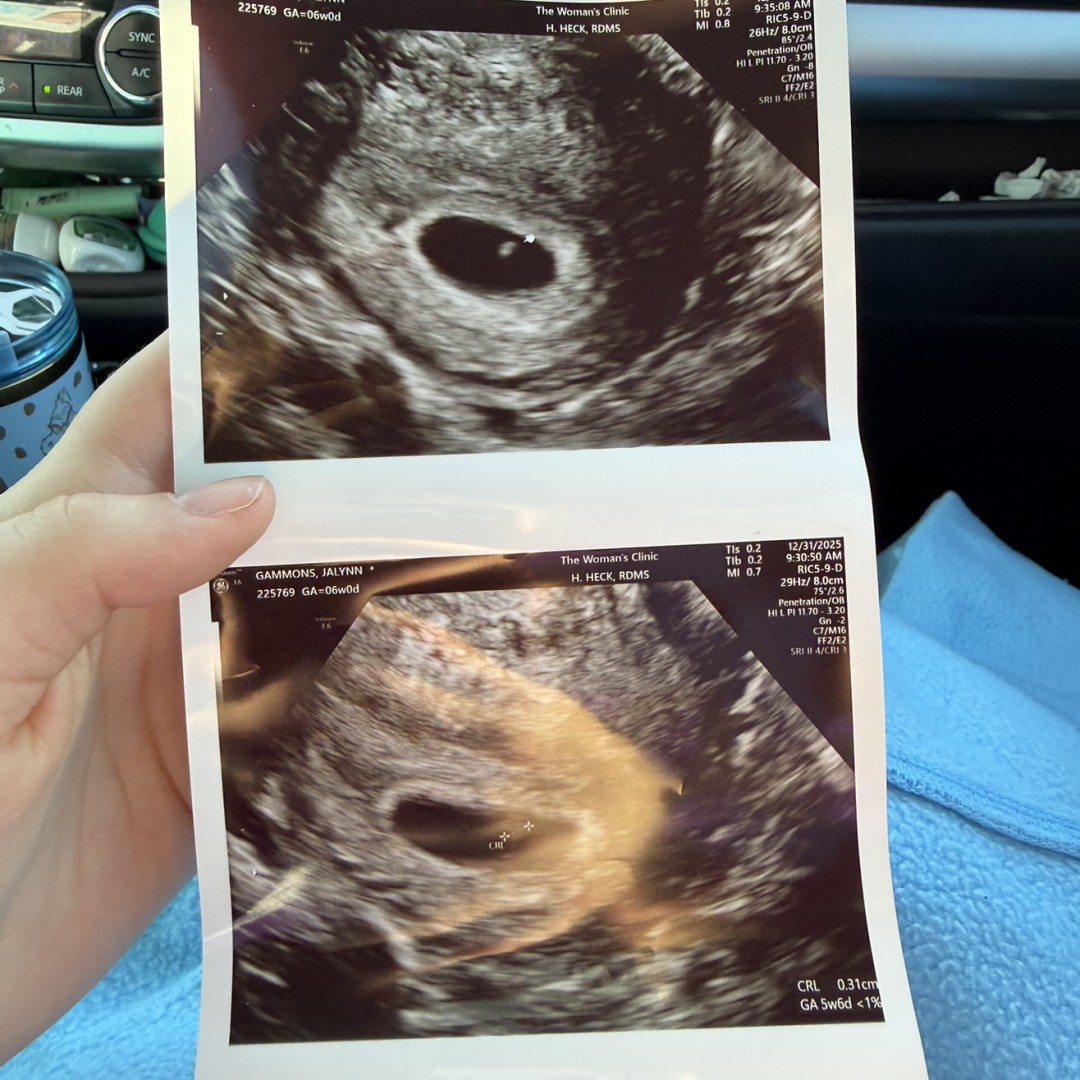 Photo shared by Jalynn for their Babylist baby registry.