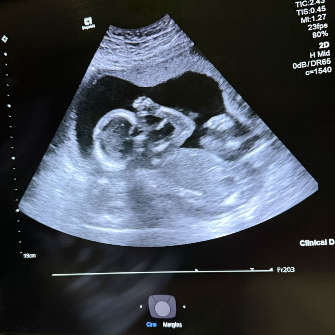 Photo shared by Malory for their Babylist baby registry.