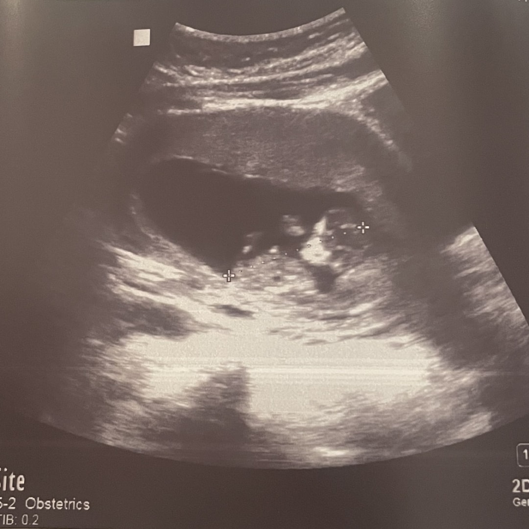 Photo shared by Claire for their Babylist baby registry.