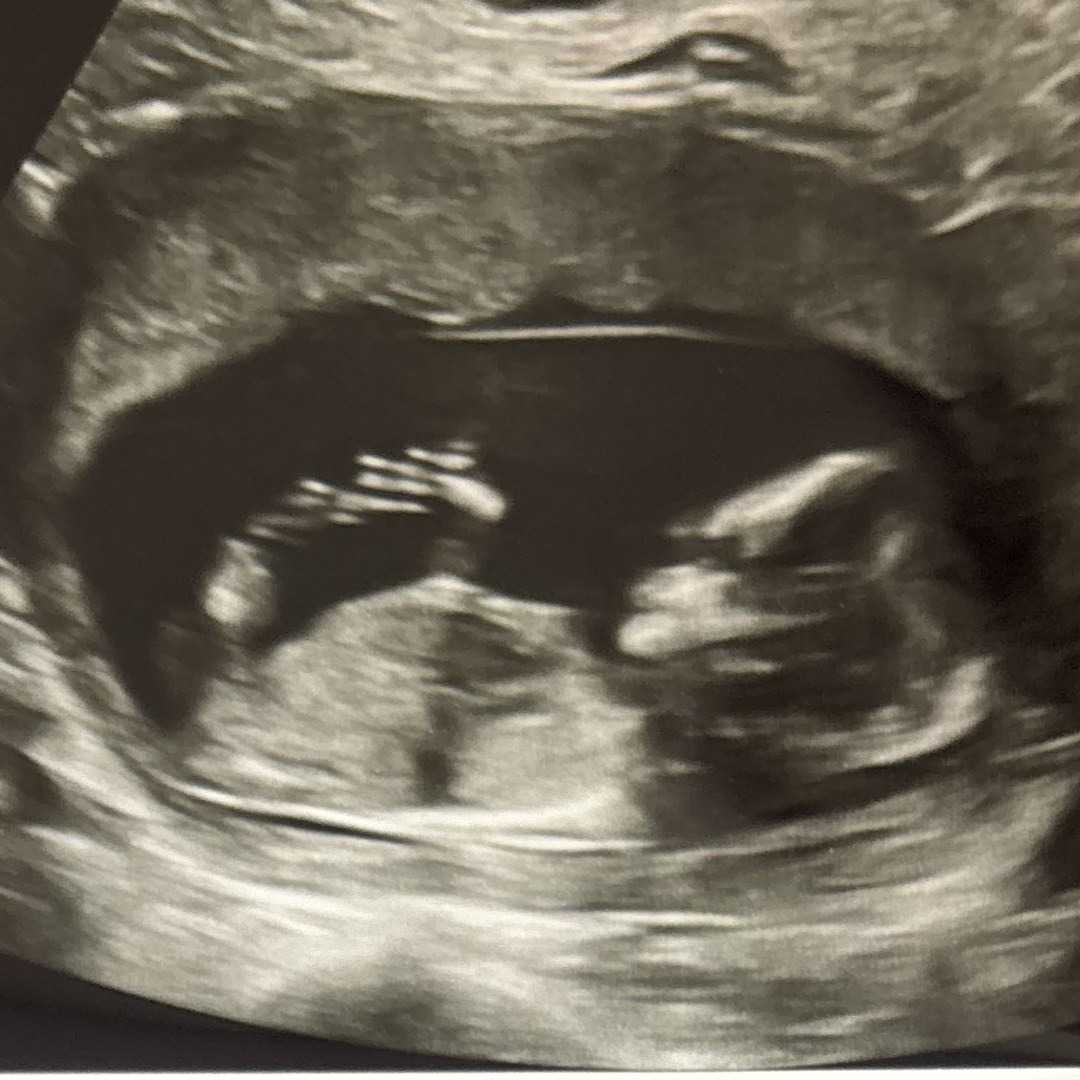 Photo shared by Jessica for their Babylist baby registry.