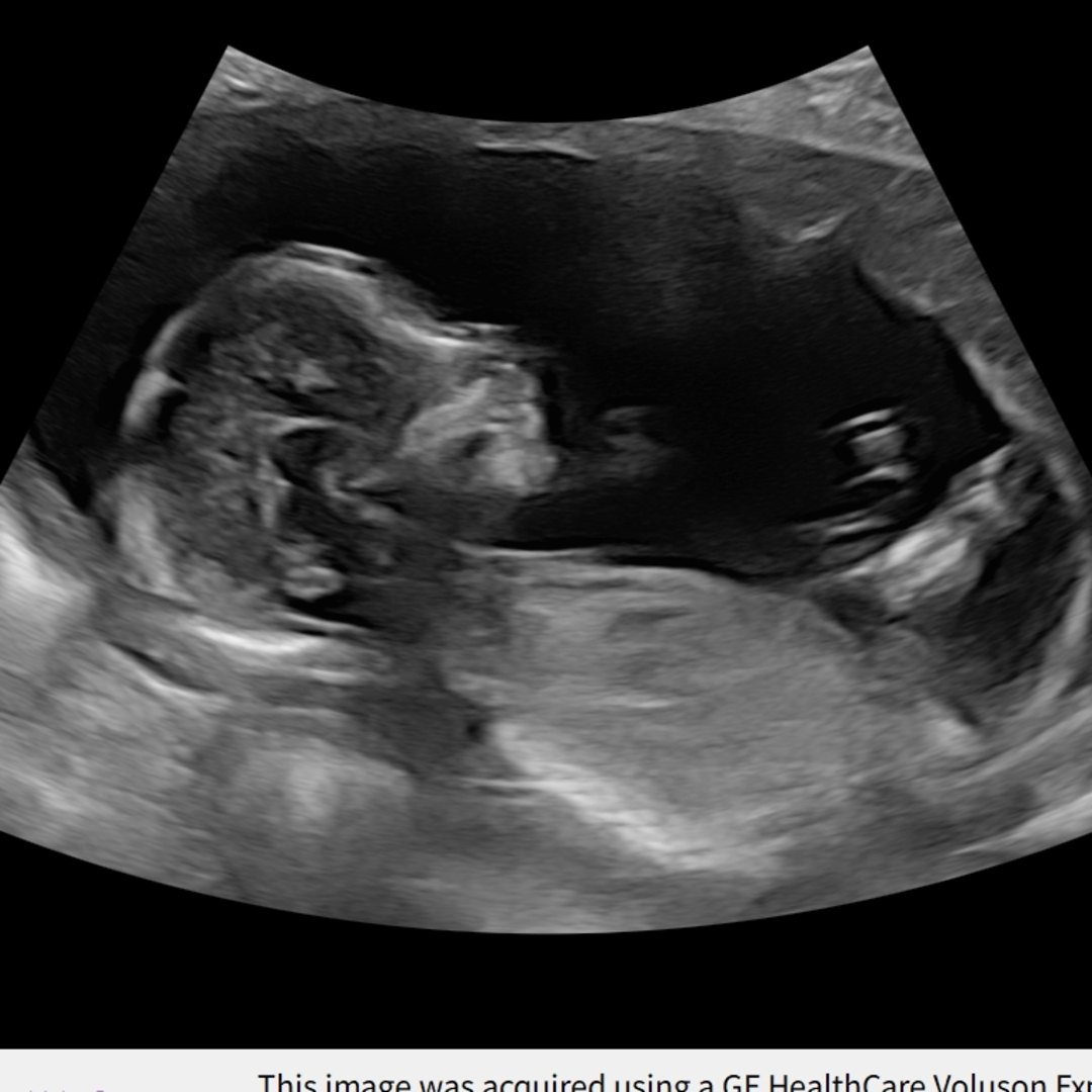 Photo shared by Margaret for their Babylist baby registry.