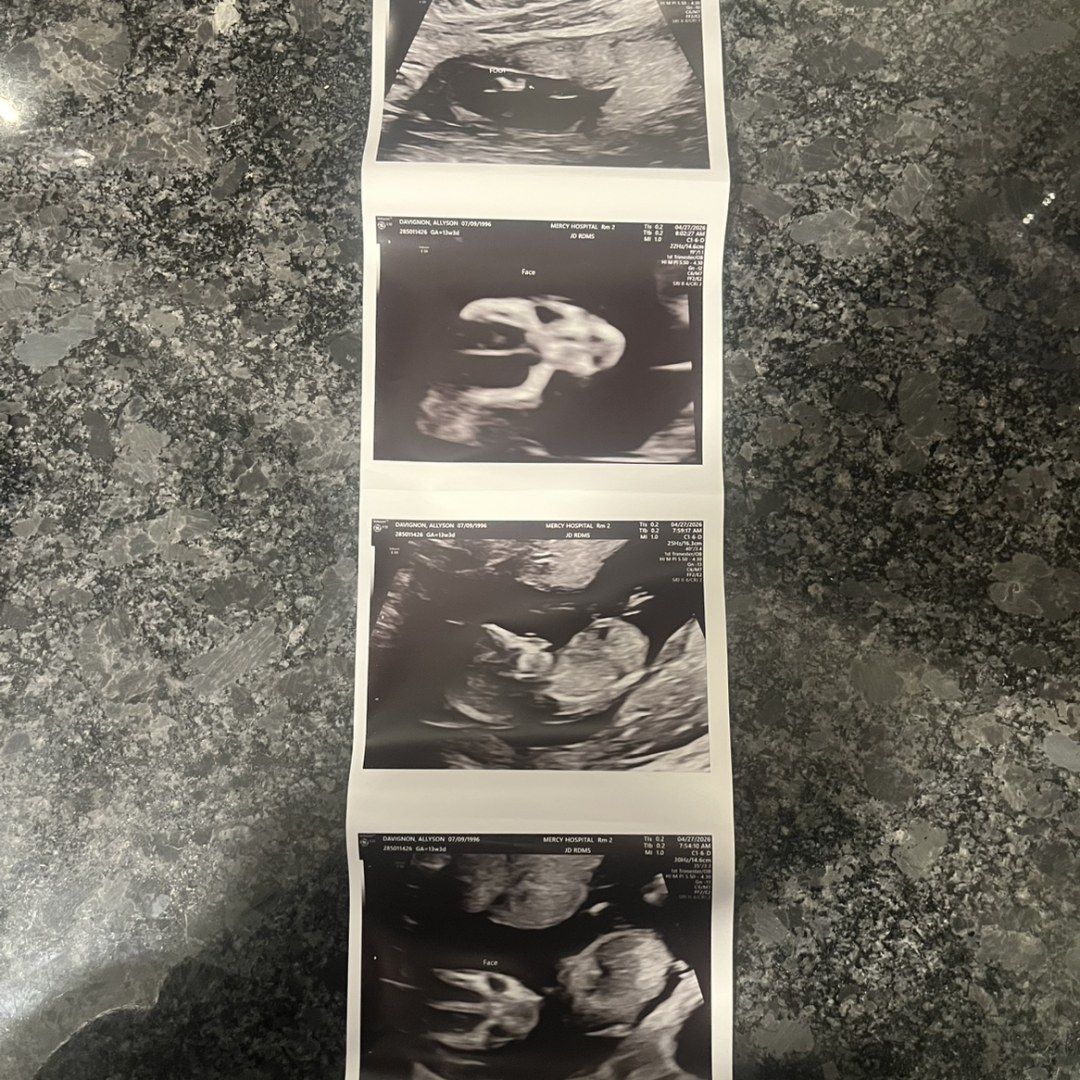 Photo shared by Allyson for their Babylist baby registry.