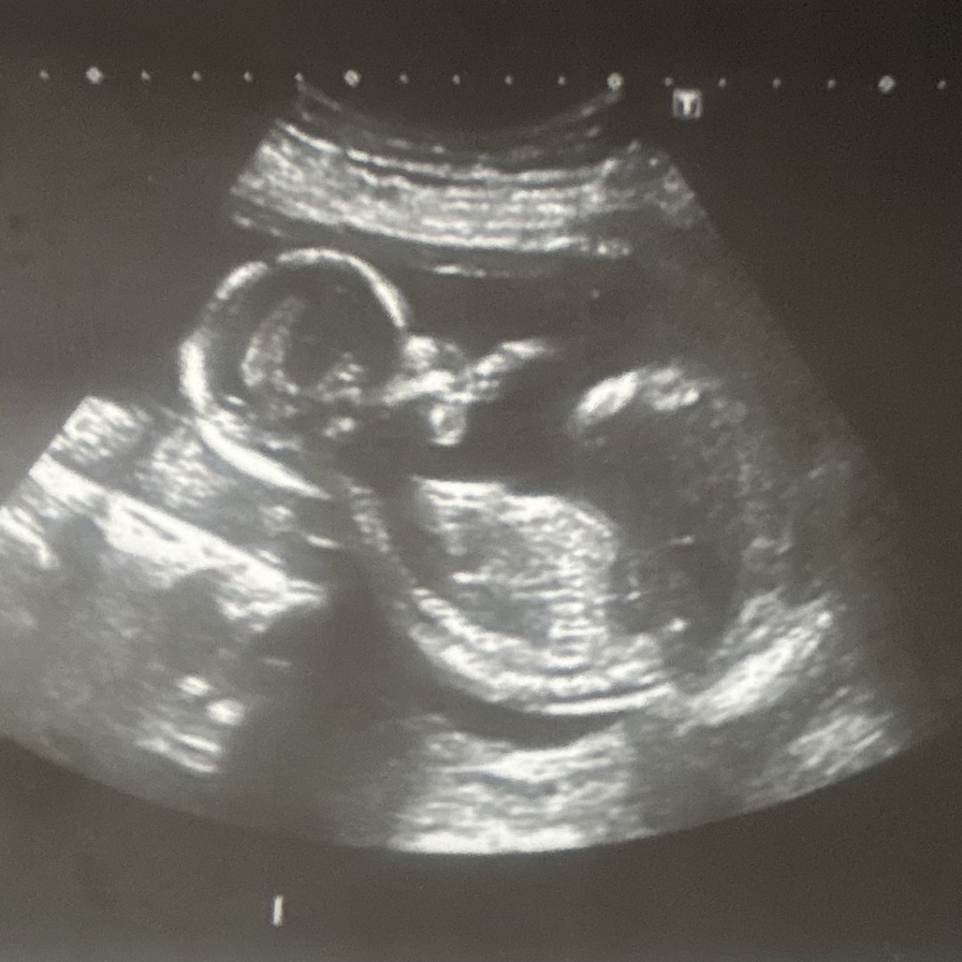 Photo shared by Jessica for their Babylist baby registry.