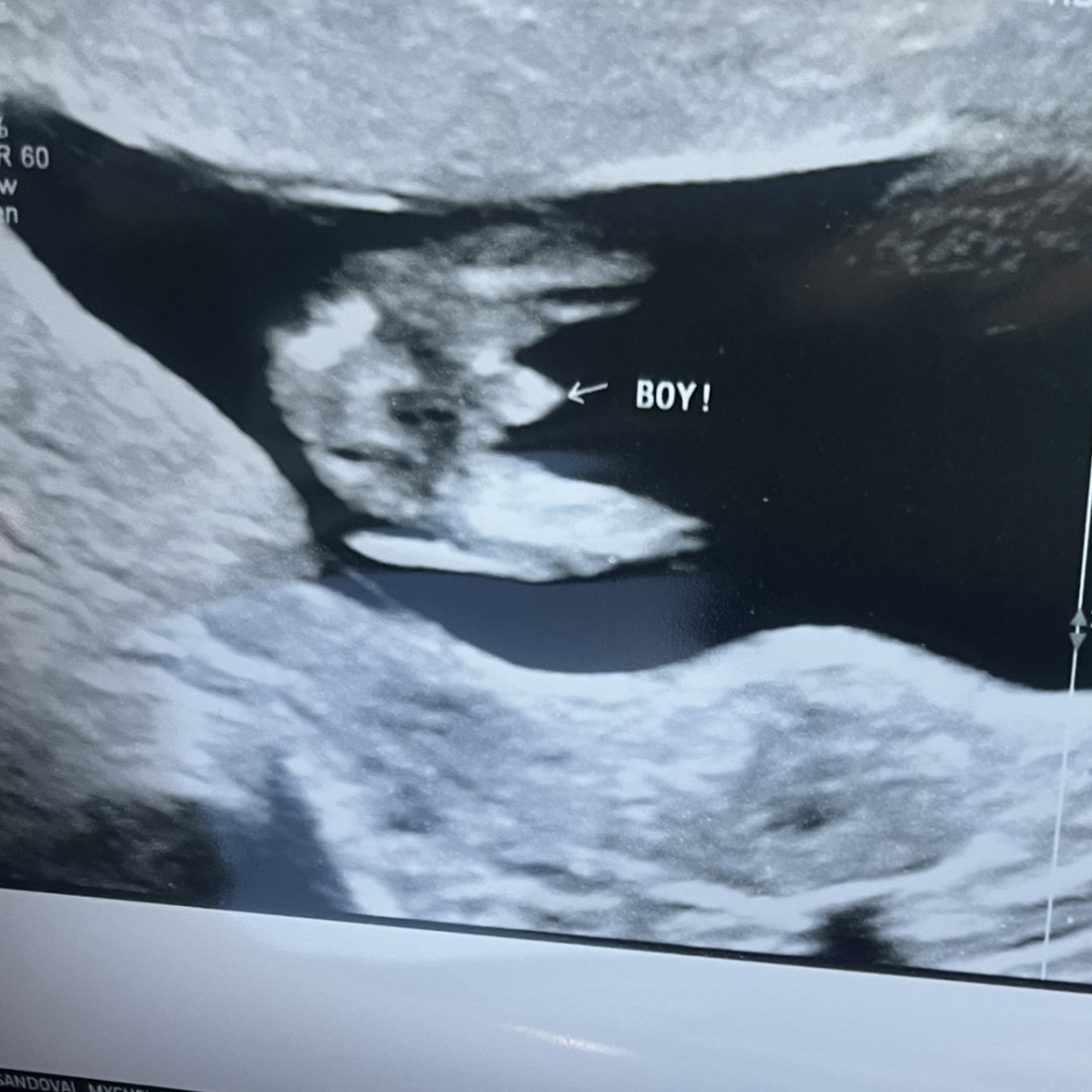 Photo shared by Mychel for their Babylist baby registry.
