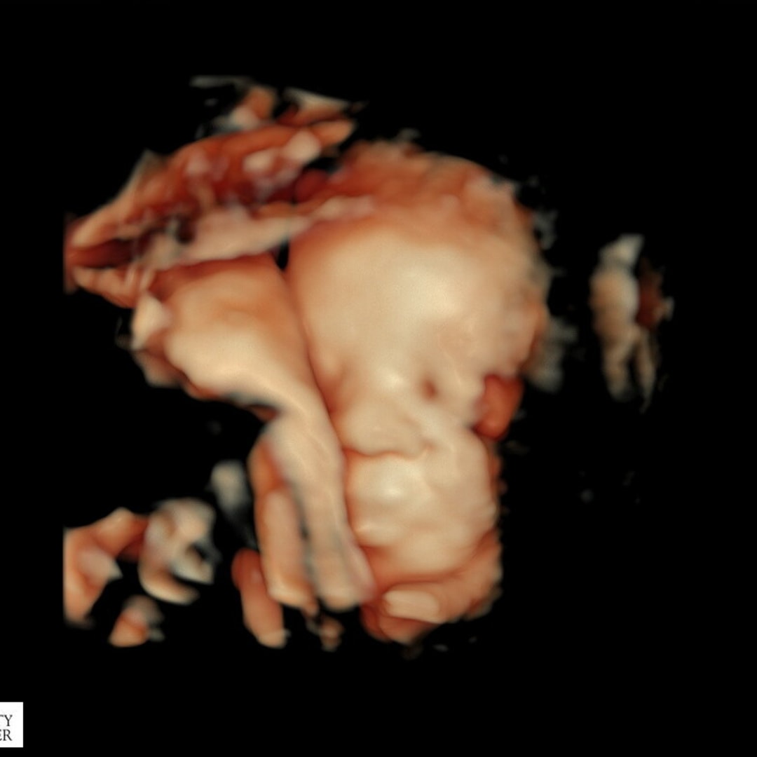 Photo shared by Taheya for their Babylist baby registry.