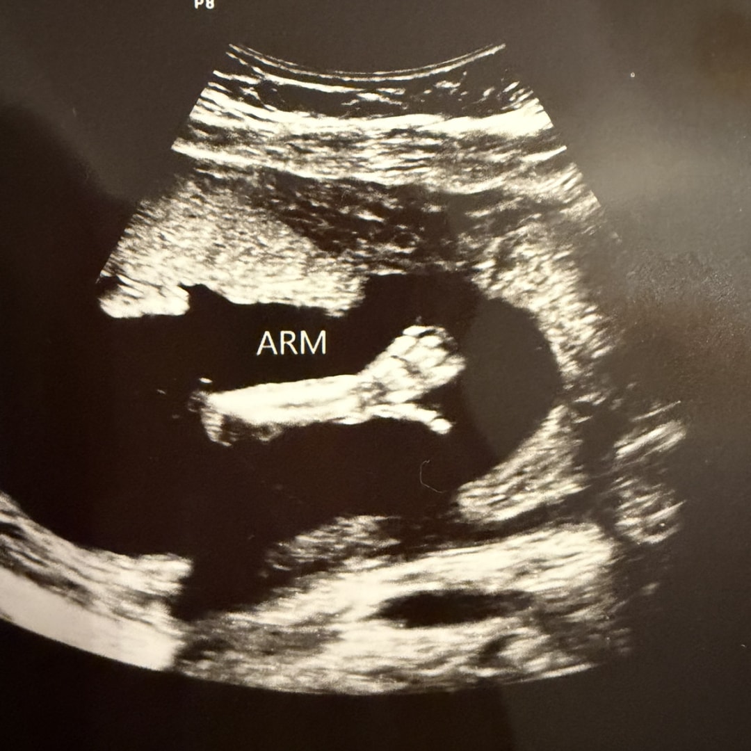 Photo shared by Annie for their Babylist baby registry.