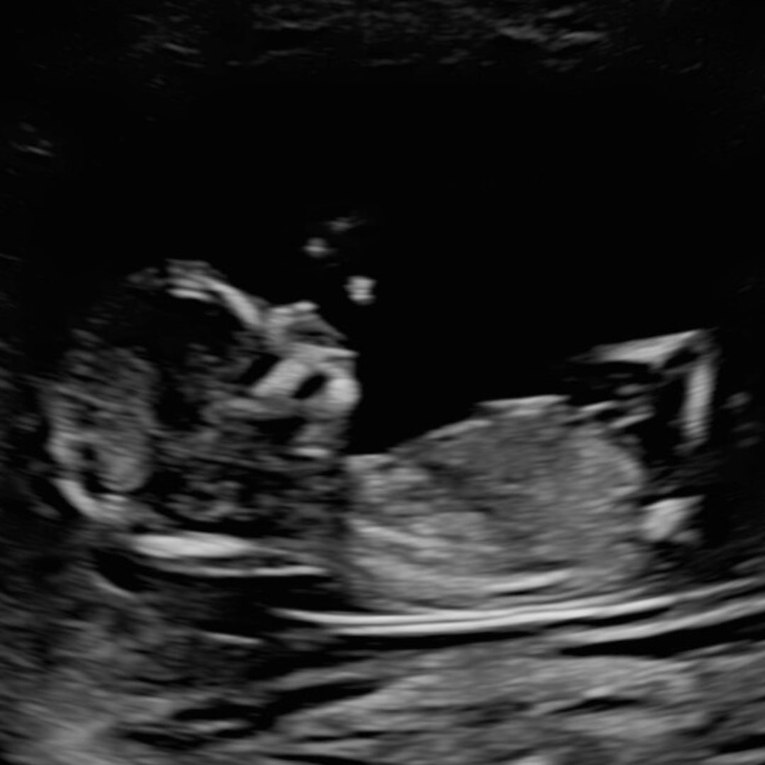 Photo shared by Katherine for their Babylist baby registry.