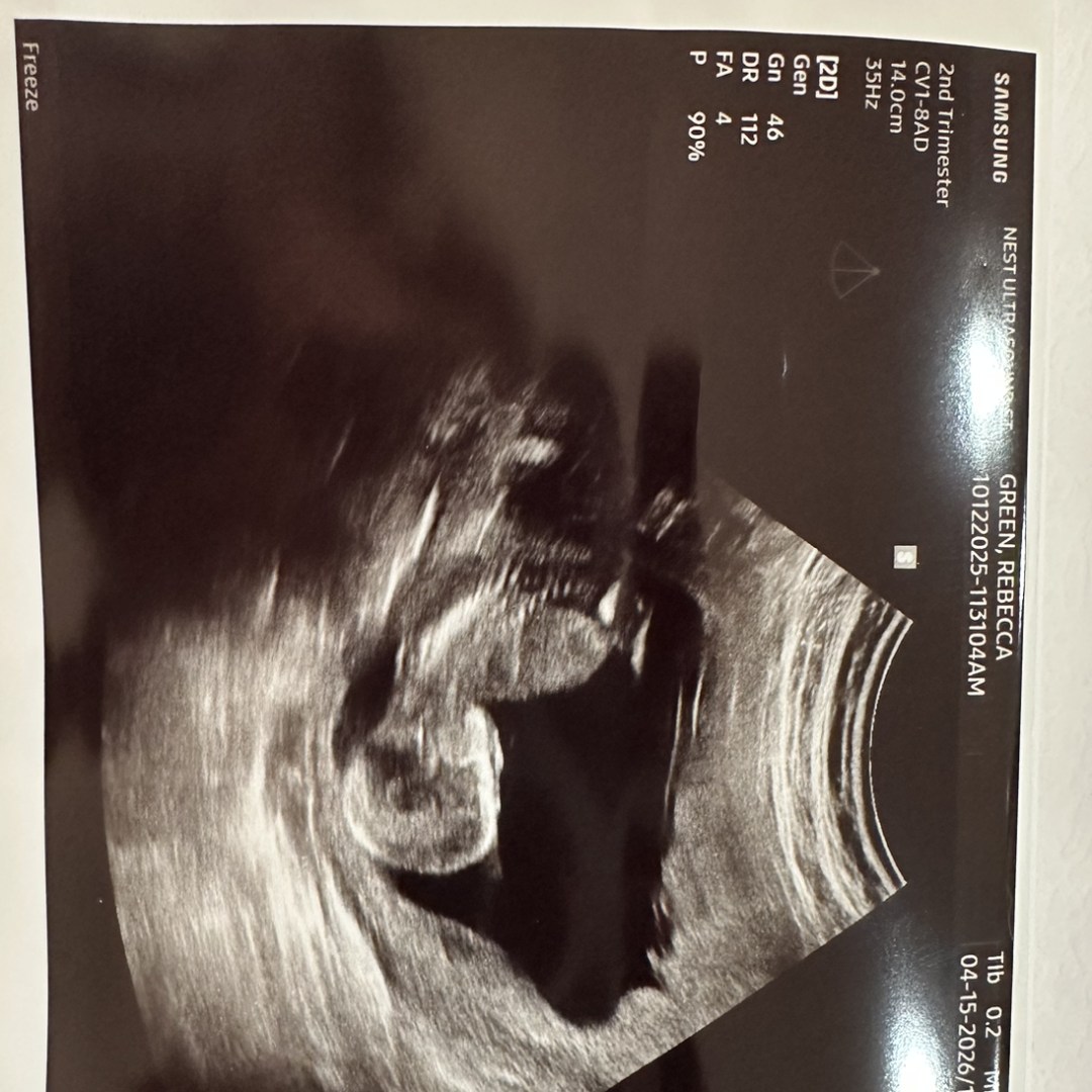 Photo shared by Rebecca for their Babylist baby registry.