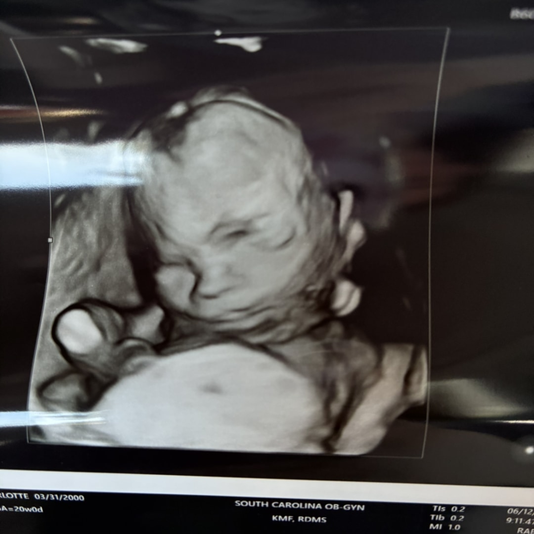 Photo shared by Charlotte for their Babylist baby registry.