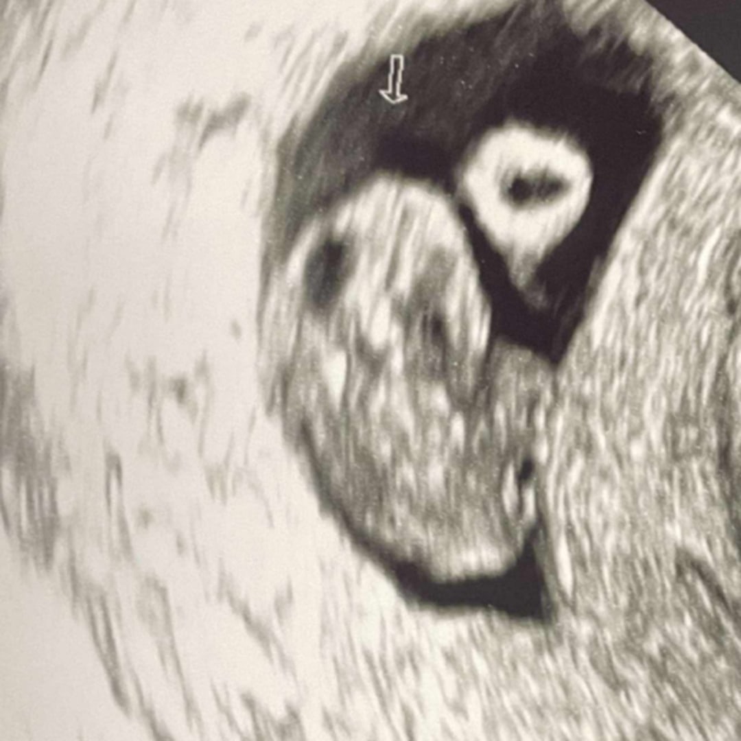 Photo shared by Zachary for their Babylist baby registry.