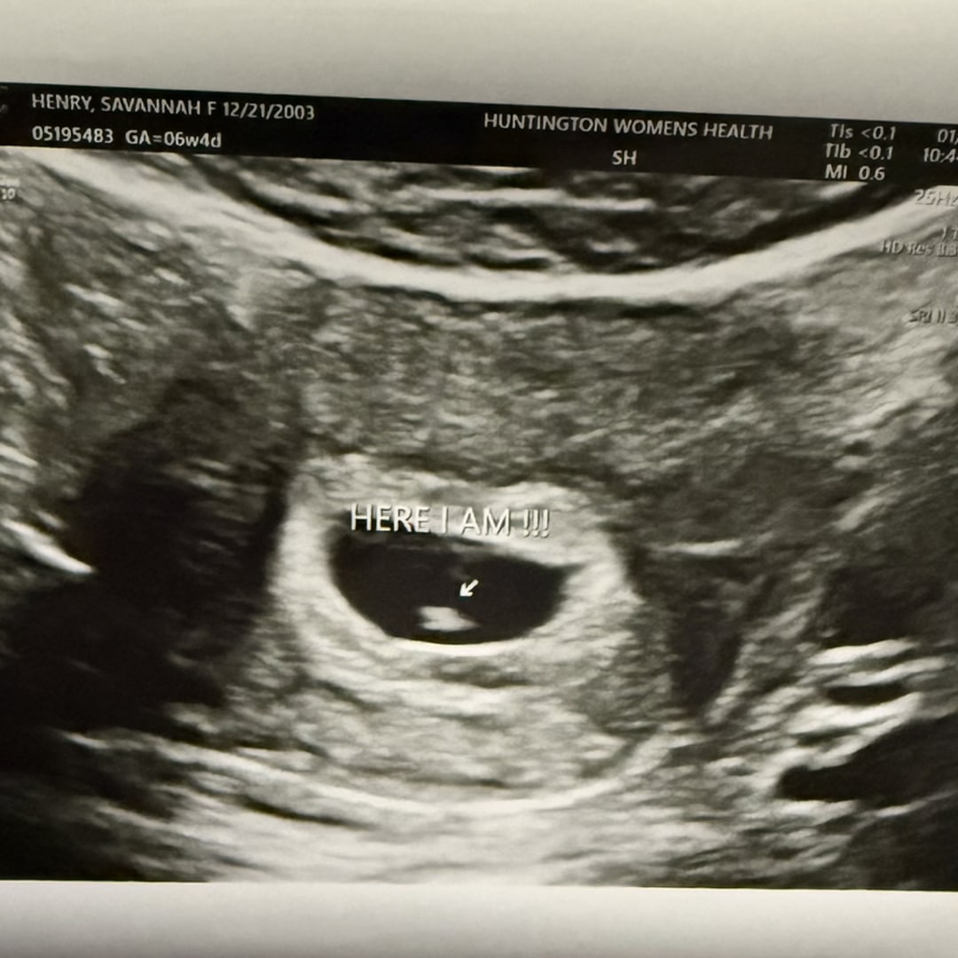 Photo shared by Savannah for their Babylist baby registry.