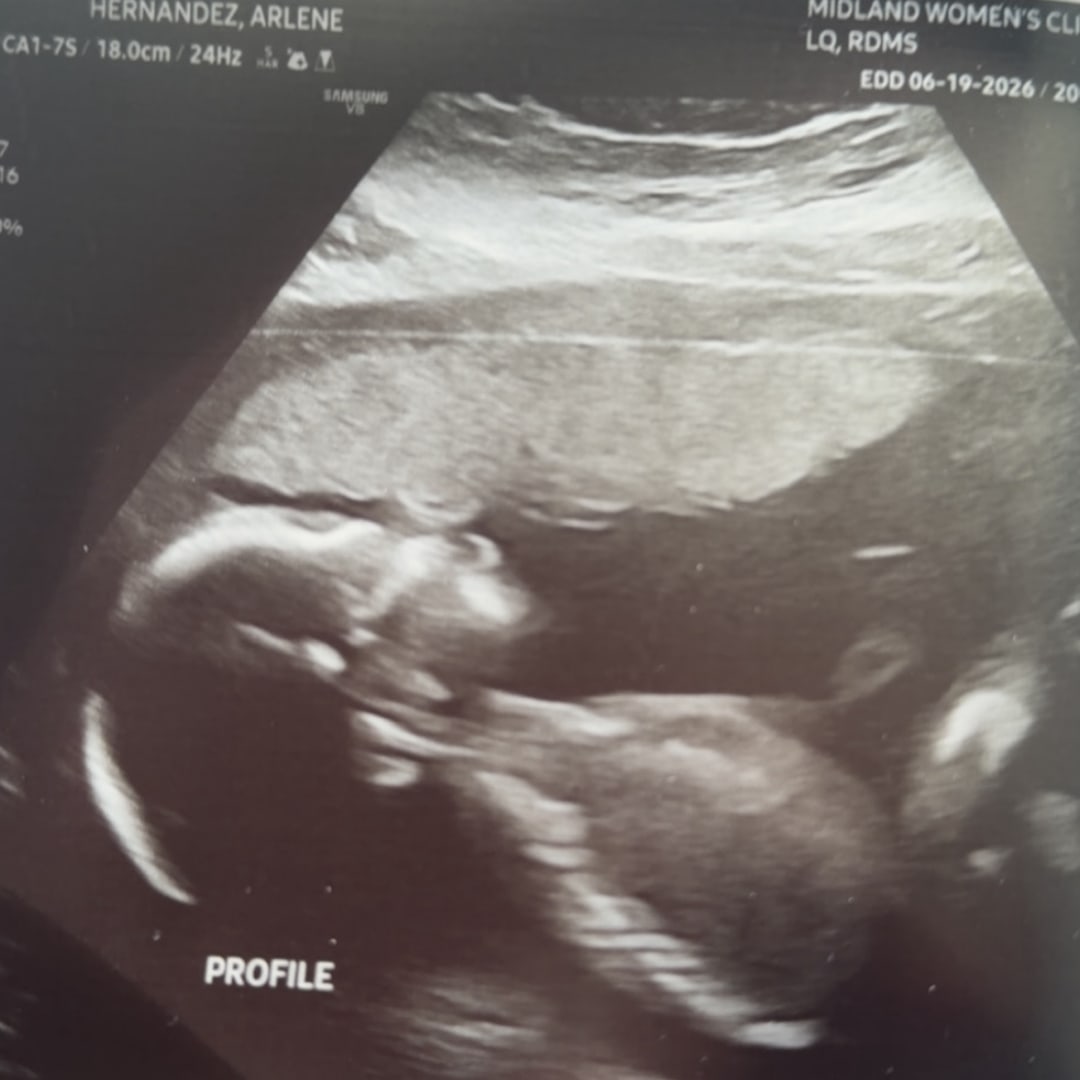 Photo shared by Arlene for their Babylist baby registry.