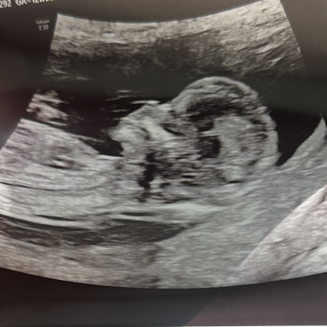 Photo shared by Jennifer for their Babylist baby registry.