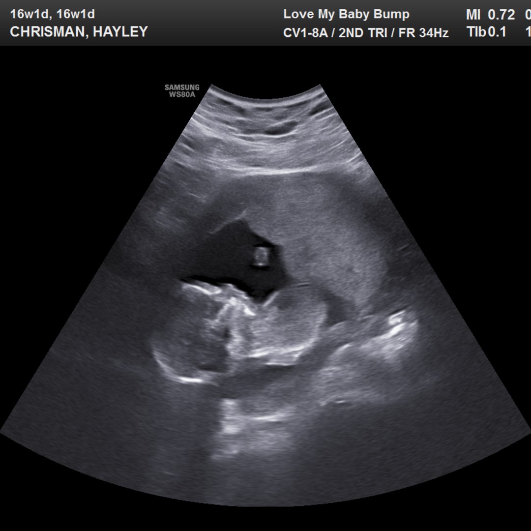 Photo shared by Hayley for their Babylist baby registry.